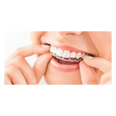 Descuento de hasta € en un tratamiento Invisalign de ortodoncia